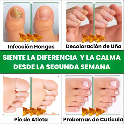 🔝Bye Bye Hongos → Renueva Uñas Premium