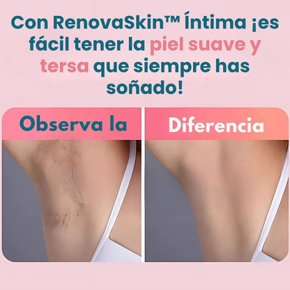RenovaSkin™ Íntima ❄ ¡Tu piel estará suave, tersa y sin vell0!